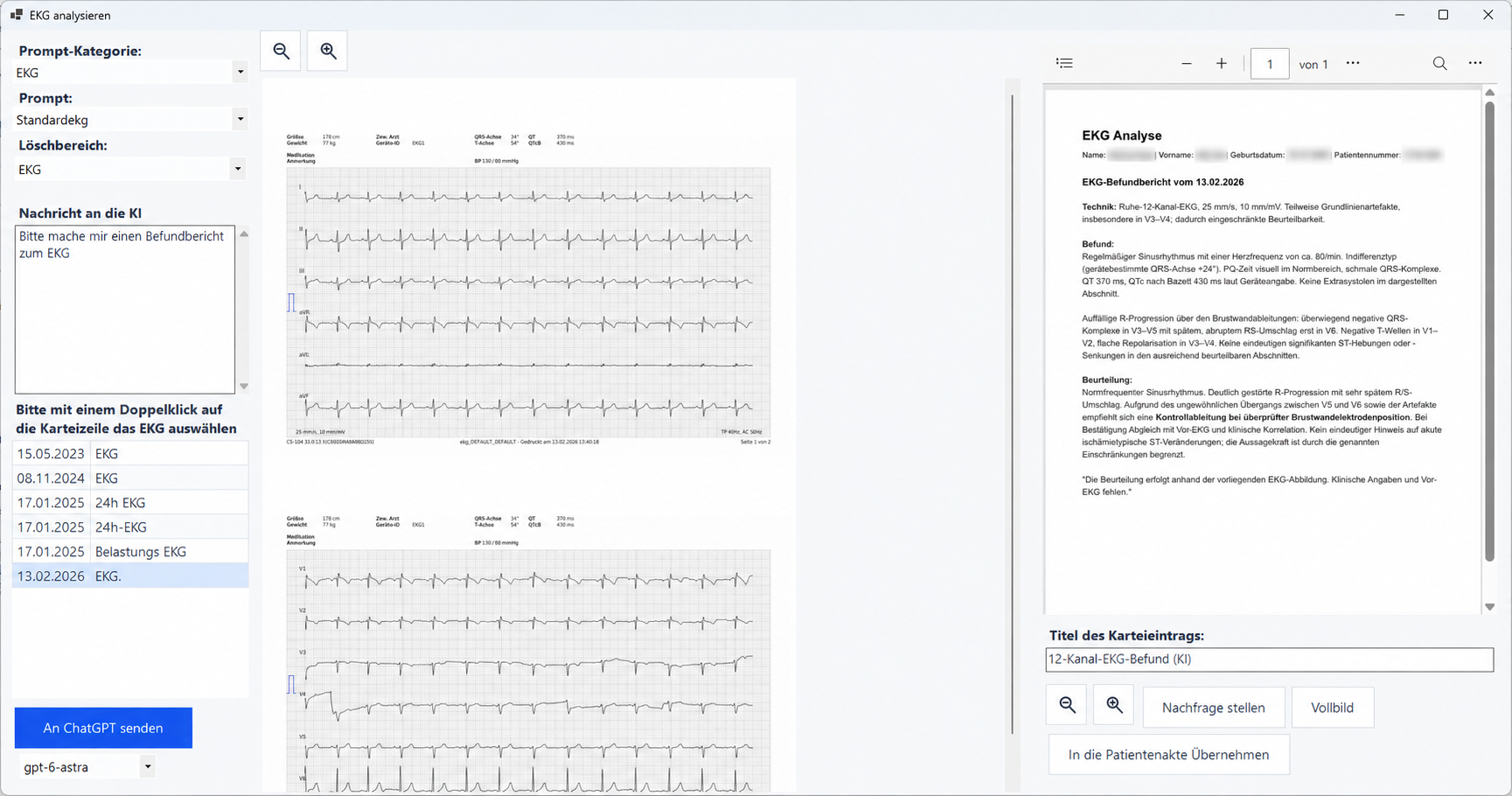 EKG-Analyse im Euvejo