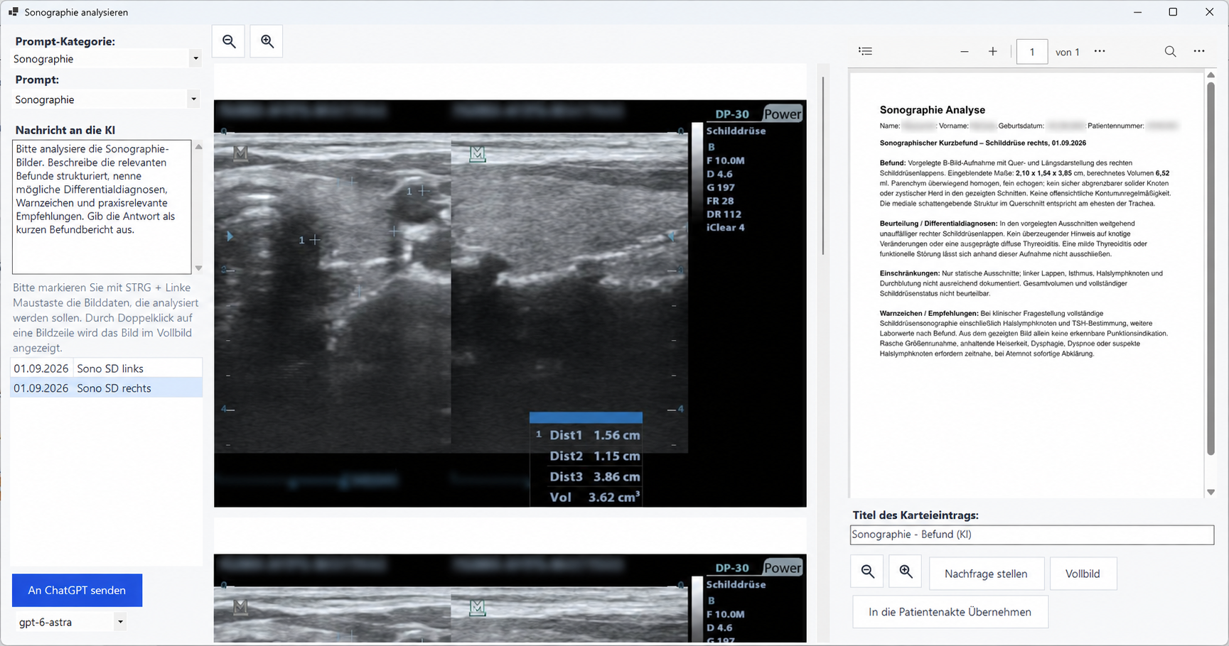 Sonographie-Analyse im Euvejo